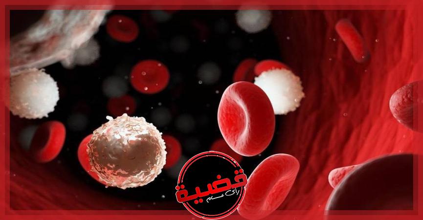 دراسة جديدة تكشف ”جين” يطور سرطان الدم